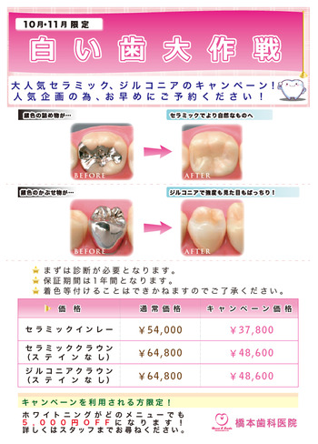 拡大：白い歯大作戦