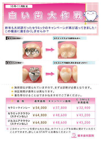 白い歯キャンペーン2014