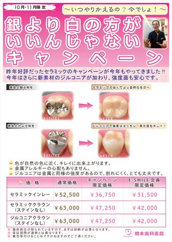 拡大：銀より白の方がいいんじゃないキャンペーン