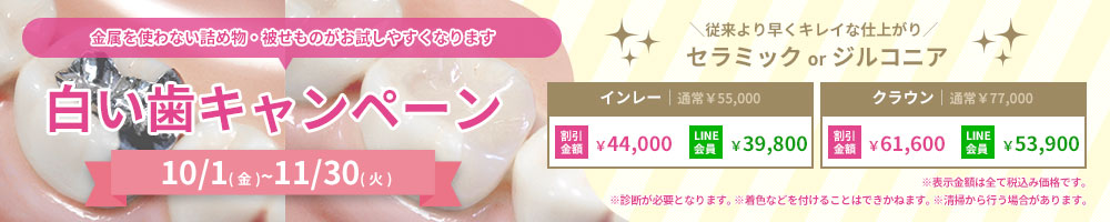 白い歯キャンペーン